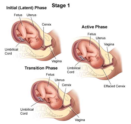 stages of labor and delivery video