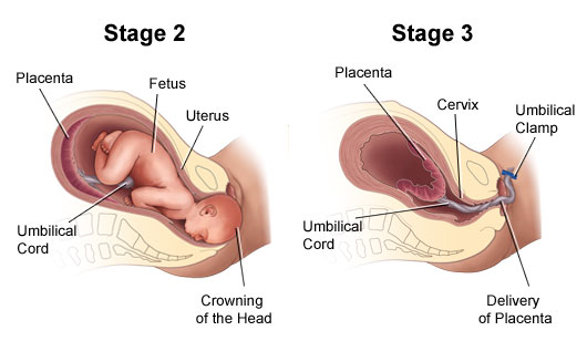 Labor Stages 2 and 3