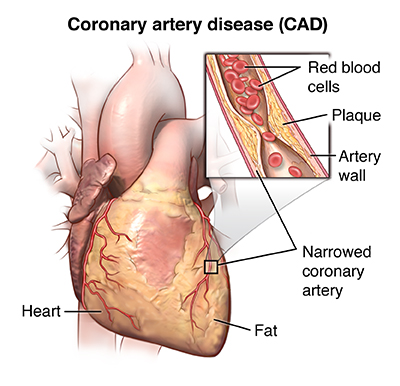 What are the different types of cardiac stress tests?