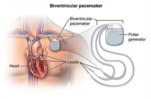 PCardio_20140402_v0_006 PCardio_20140402_v0_006