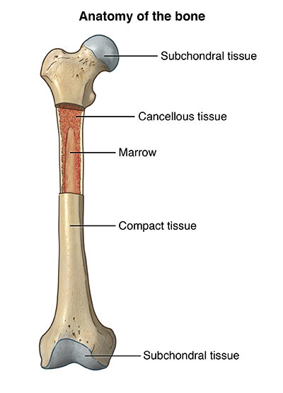 What is a bone lesion biopsy?