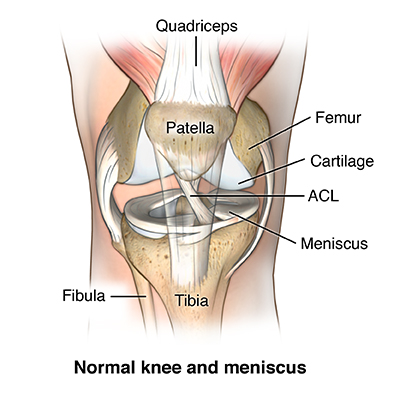 Ligament Injuries to the Knee - Stanford Medicine Children's Health