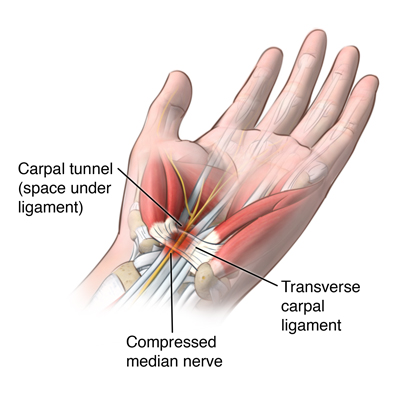 emg sciatic nerve