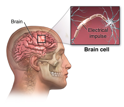 what is epilepsy