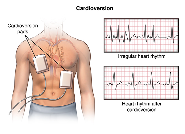 PCardio_20140401_v0_002 PCardio_20140401_v0_002