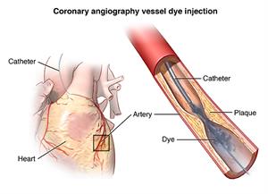 PCardio_20140401_v0_003 PCardio_20140401_v0_003
