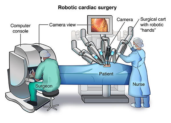 Robotic-Assisted Cardiac Surgery