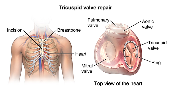 tricuspid valve