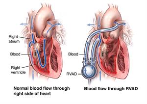 PCardio_20140527_v0_002