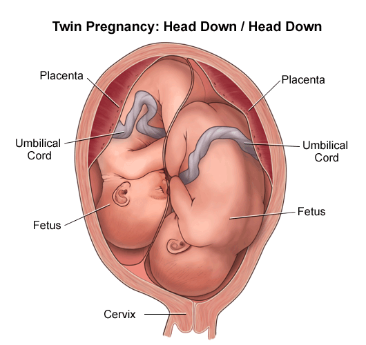 pregnant multiples