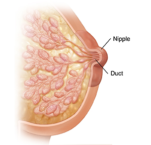 Breast Anatomical Model Cross-Section Pathologies