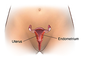 Front view of woman's pelvic area with cross section of uterus showing endometrium.