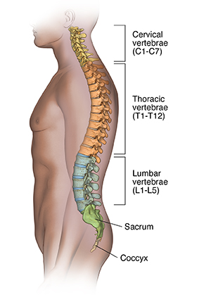 Lumbar Strain (Weight Lifter's Back)