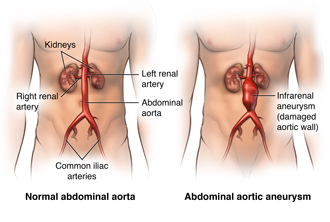 Location of the aorta in the body
