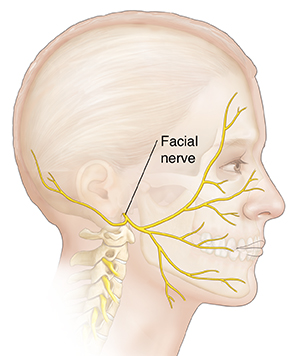 Side view of man’s head showing facial nerve.