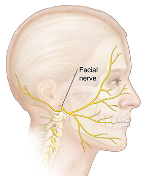 Bells Palsy - Head And Face - Surgery - What We Treat 