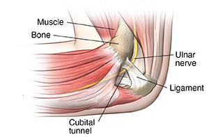 Inside side view of elbow showing forearm muscles and ulnar nerve in cubital tunnel.